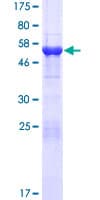 Human MMADHC / C2orf25 Protein (Recombinant GST)