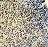 Polyclonal Rabbit anti-Human NR5A1 / SF1 Antibody (aa64-93, IHC, WB)