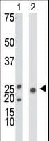 KHK / Ketohexokinase Antibody (aa18-46)