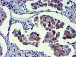 GOLM1 / GP73 / GOLPH2 Antibody (clone OTI2F3)