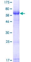 Human SLC10A4 Protein (Recombinant GST)