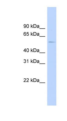 HTR2B / 5-HT2B Receptor Antibody (aa35-84, FITC)