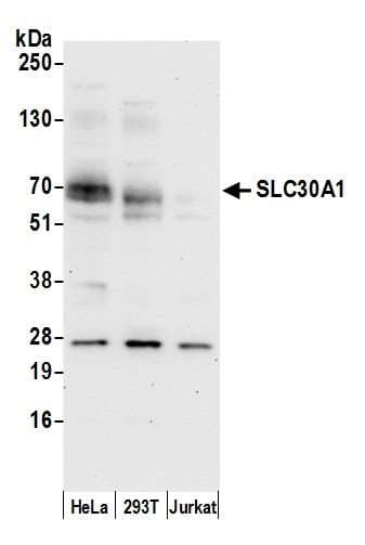 SLC30A1 / ZNT1 Antibody (aa200-250)