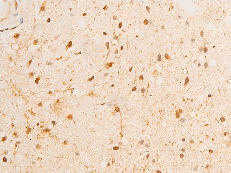 GSK3B / GSK3 Beta Antibody (phospho-Ser9)