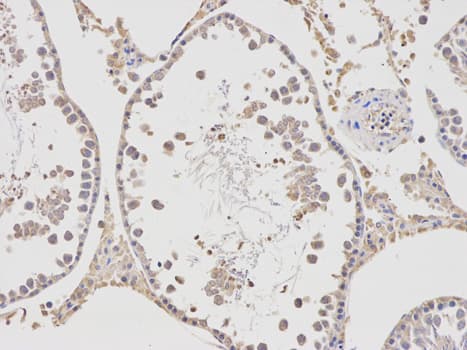 APBB1 / FE65 Antibody