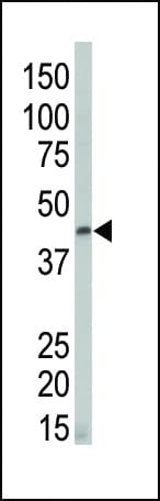 DAPK2 / DAP Kinase 2 Antibody (aa40-70)