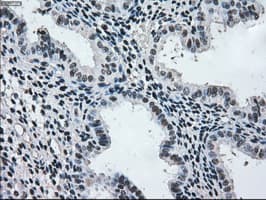 MAP2K2 / MKK2 / MEK2 Antibody (clone OTI8G6)