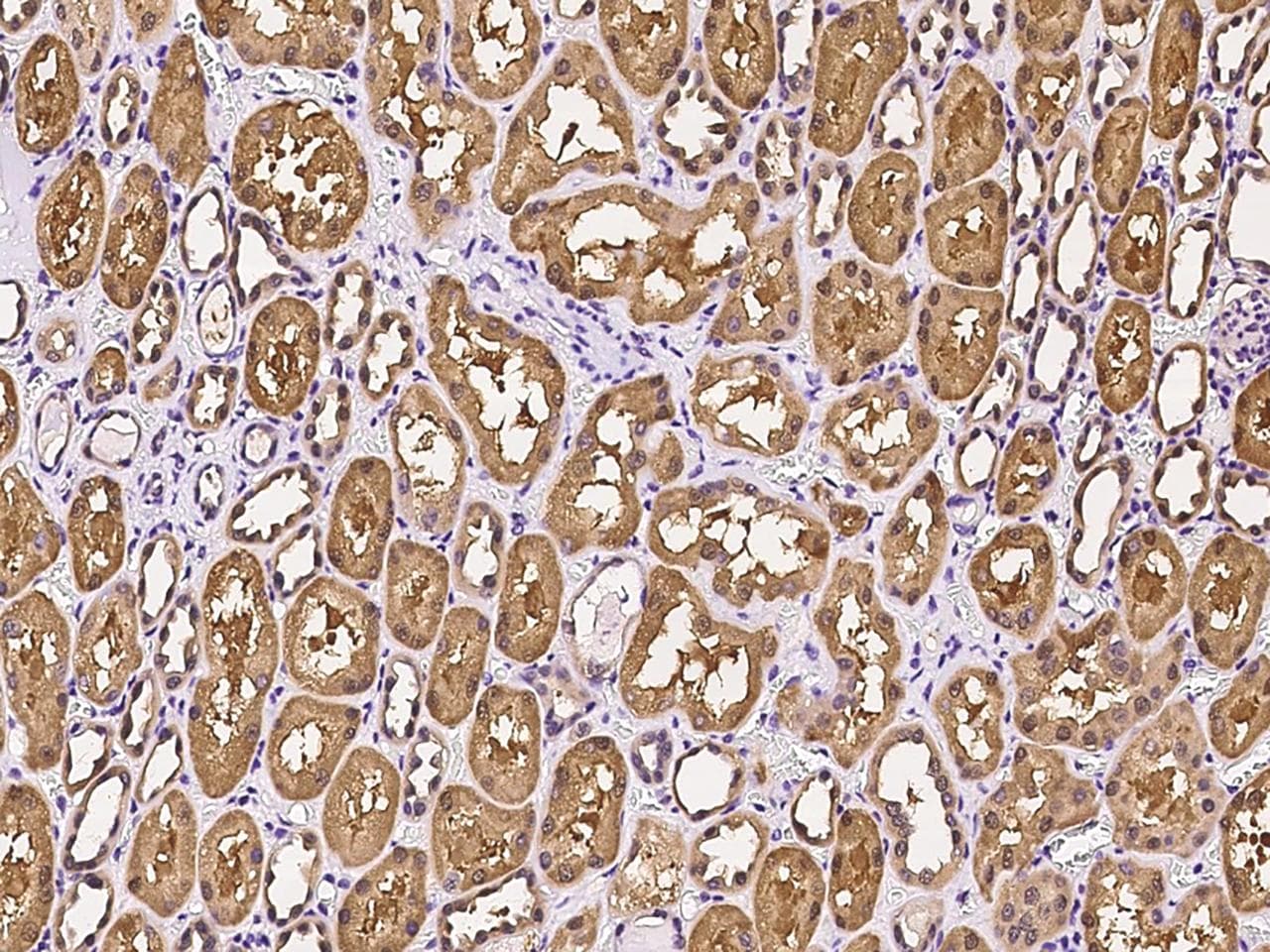 Polyclonal Rabbit anti-Human PNPO Antibody (IHC, WB)