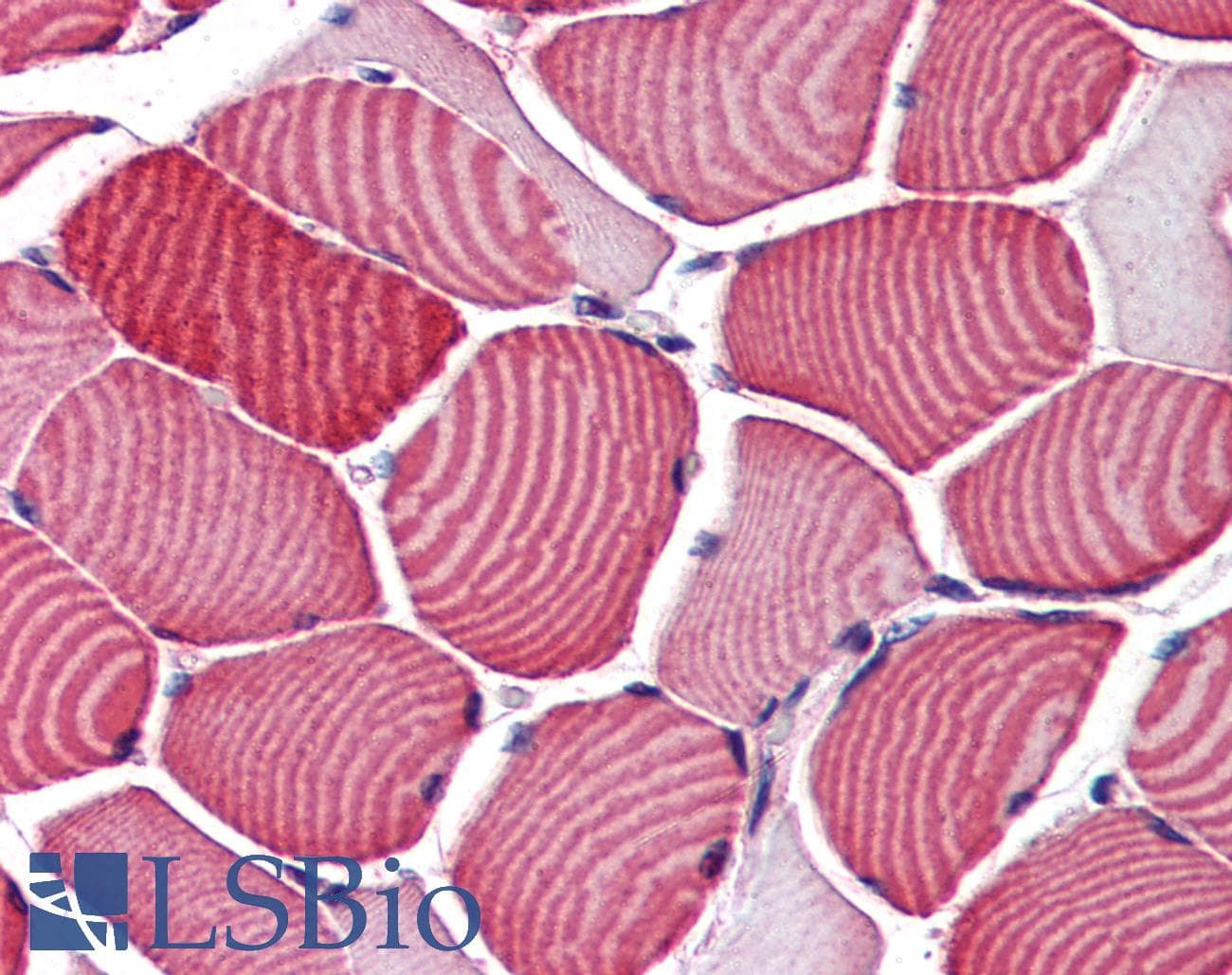 IHC-plus™ TBC1D4 / AS160 Antibody (aa825-837)