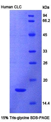 Human CLC Protein (Recombinant His)
