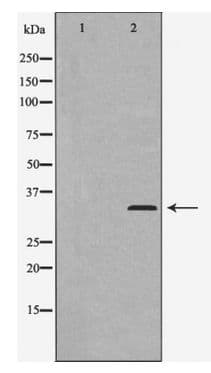 Polyclonal Rabbit anti-Human CCNC / Cyclin C Antibody (WB)