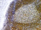 BIRC7 / Livin Antibody (aa199-217)