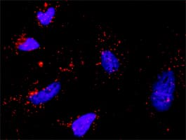 IHC-plus™ p66 / SHC Antibody (clone 3F4)