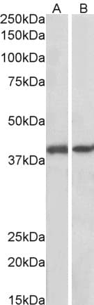 IHC-plus™ Polyclonal Goat anti-Human GNAQ Antibody (aa162-175, IHC, WB)