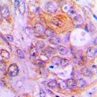 Polyclonal Rabbit anti-Human CASP1 / Caspase 1 Antibody (Internal, IHC, WB)