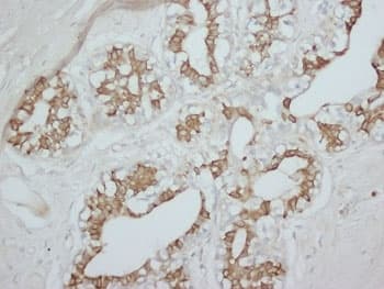 PRKCA / PKC-Alpha Antibody (C-Terminus)