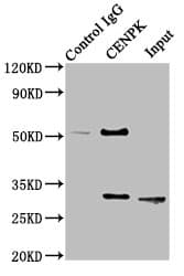 Polyclonal Rabbit anti-Human CENPK Antibody (IHC, WB)