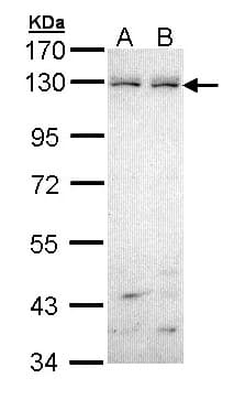 EPHB6 / EPH Receptor B6 Antibody