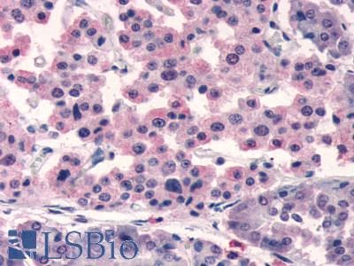IHC-plus™ SSTR5 Antibody (C-Terminus)