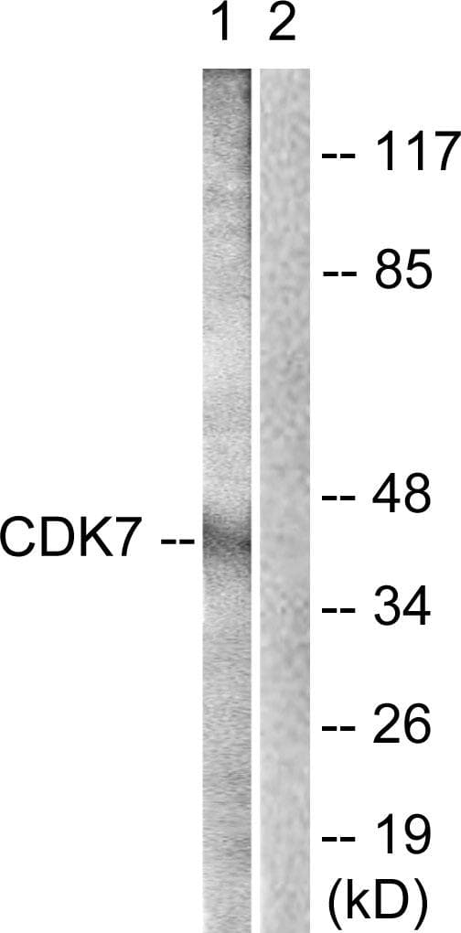 CDK7 Antibody (p170)