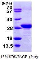 Human EF1B / EEF1B2 Protein (Recombinant His)