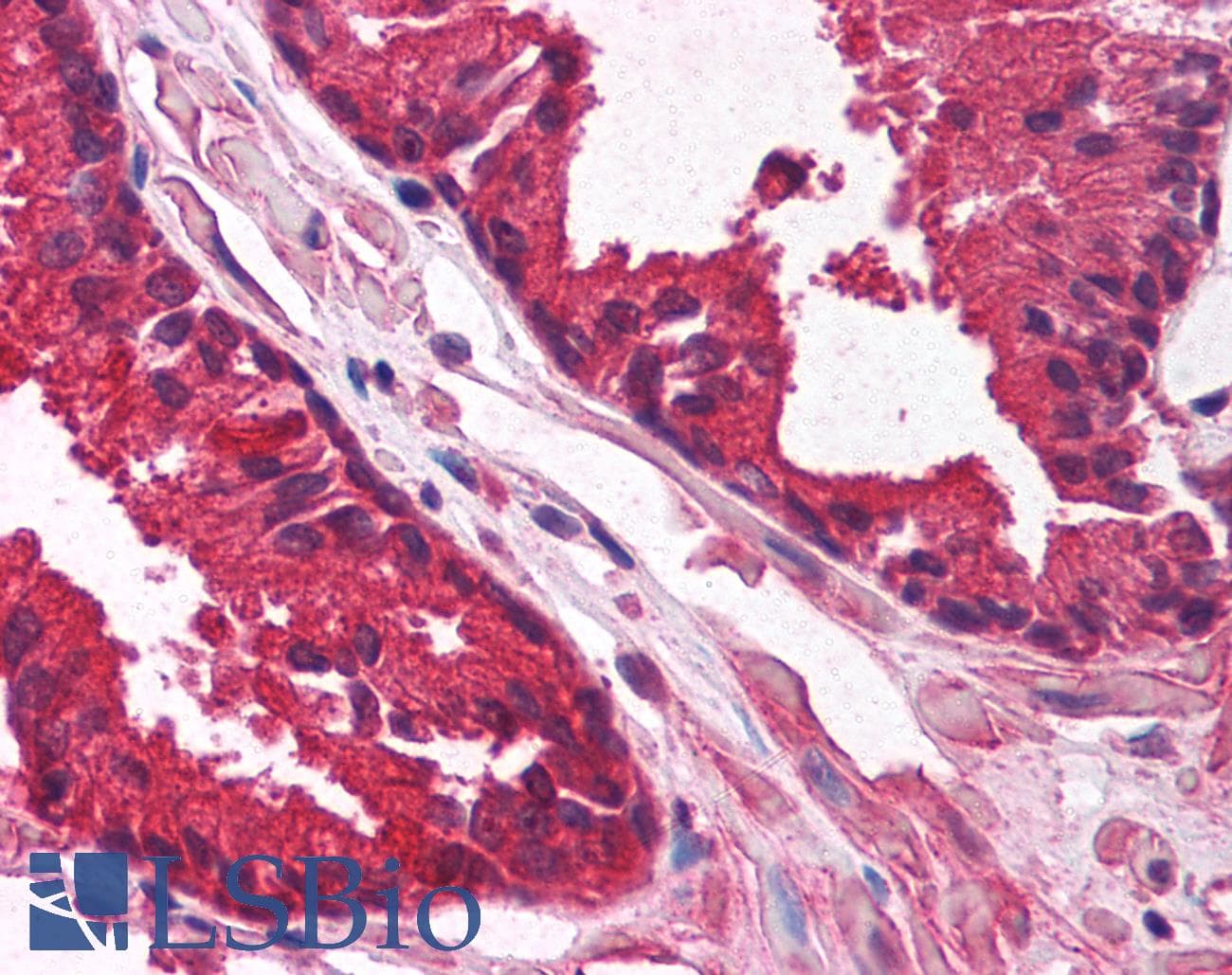 KLF6 Antibody (aa155-204)
