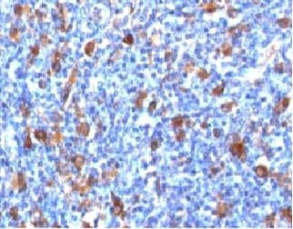 FSCN1 / Fascin Antibody (clone FAN55-1, Azide-free, BSA-free)