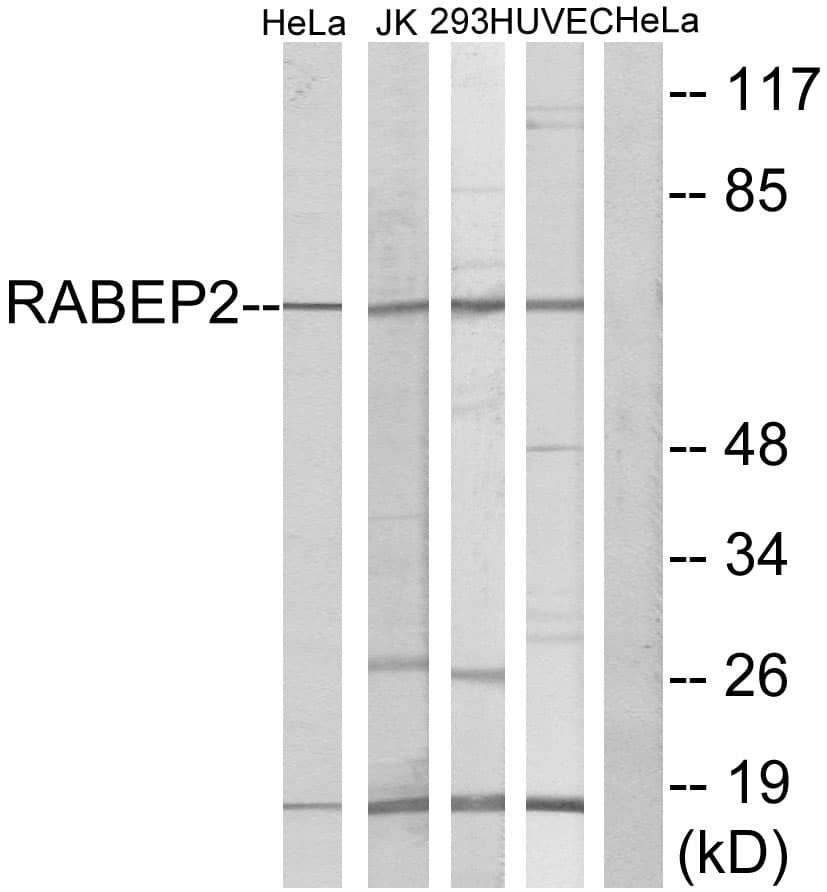 IHC-plus™ RABEP2 Antibody (aa353-402)