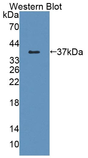 TMEM1 / TRAPPC10 Antibody (aa74-357, PE)