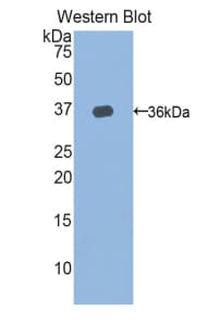 TERT / Telomerase Antibody (aa673-976)