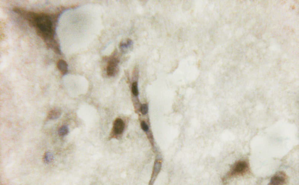 BIRC5 / Survivin Antibody (phospho-Thr117)