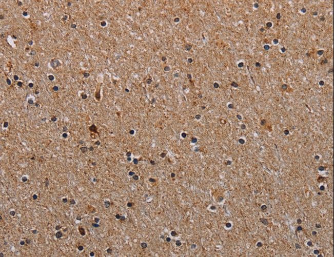 NDUFA8 Antibody