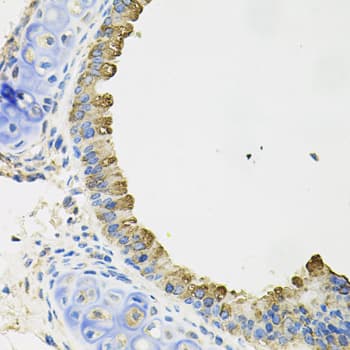 Polyclonal Rabbit anti-Human AIF1 / IBA1 Antibody (IHC, IF, WB)