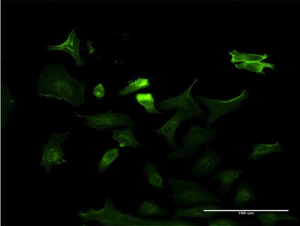 Monoclonal Mouse anti-Human NTRK3 / TRKC Antibody (clone 4D5, IF)