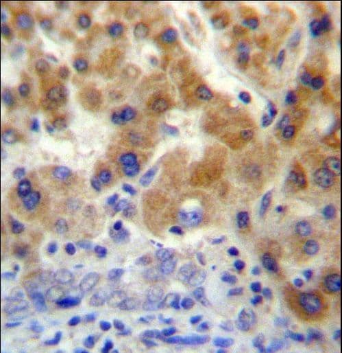 NT5C3B / NT5C3L Antibody (aa70-98)