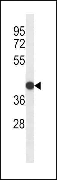 RDHE2 / SDR16C5 Antibody (aa123-151)