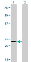 SALL2 Antibody (clone 3F7)