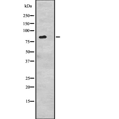 CDH6 / K Cadherin Antibody