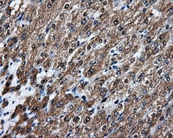 APP / Beta Amyloid Precursor Antibody (clone OTI7G9)