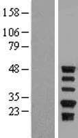Human SERPINA5 / PCI Protein (Over-Expression Lysate Myc-DDK (Flag))
