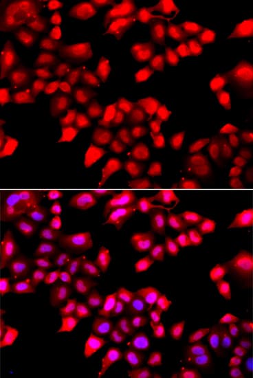 XRCC6 / Ku70 Antibody