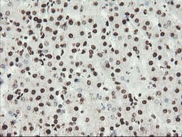 Monoclonal Mouse anti-Human NONO / P54NRB Antibody (clone OTI2E7, IHC, WB)