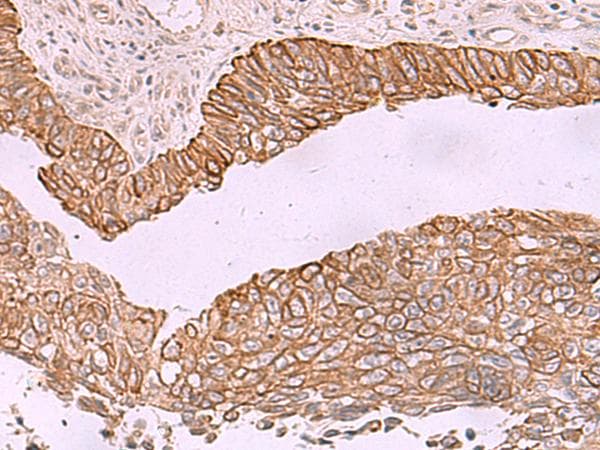 Polyclonal Rabbit anti-Human KCNK12 Antibody (IHC)