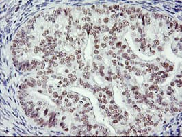 RNF113B Antibody (clone OTI1B10)