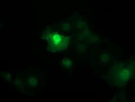 CTNNB1 / Beta Catenin Antibody (clone OTI9C1, Carrier-free)