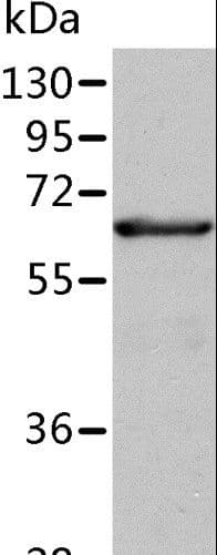 P5CDH / ALDH4A1 Antibody
