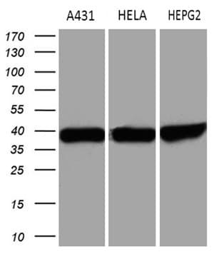 TALDO1 / Transaldolase 1 Antibody (clone OTI4A7)