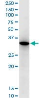 Monoclonal Mouse anti-Human RARRES1 Antibody (clone 2E2, WB)