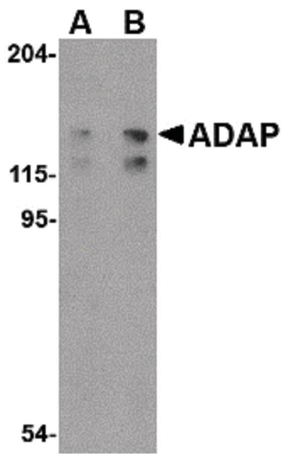 Polyclonal Rabbit anti-Human ADAP / FYB Antibody (IF, WB)