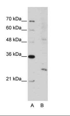 EXOSC4 / RRP41 Antibody (N-Terminus)